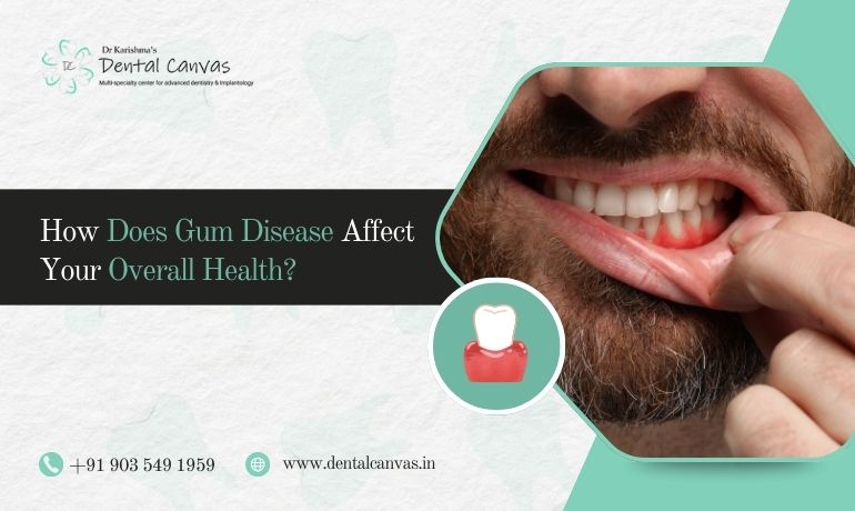gum disease treatment