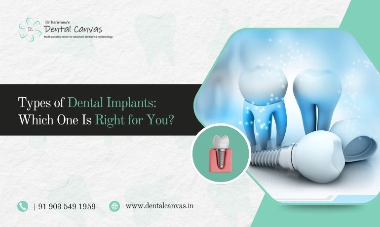 dental implants in Marathahalli