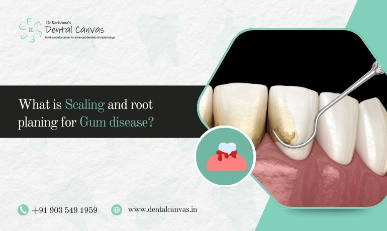 gum disease treatment